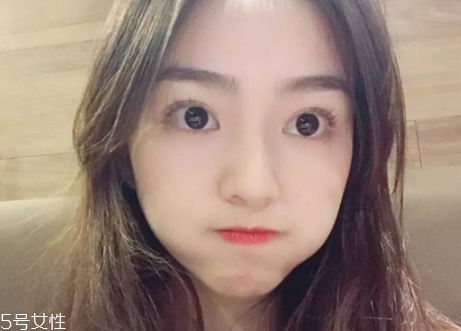 夏天割雙眼皮好還是冬天好 秋季是割雙眼皮的黃金季節(jié) 夏天割雙眼皮好還是冬天好 秋季是割雙眼皮的黃金季節(jié)