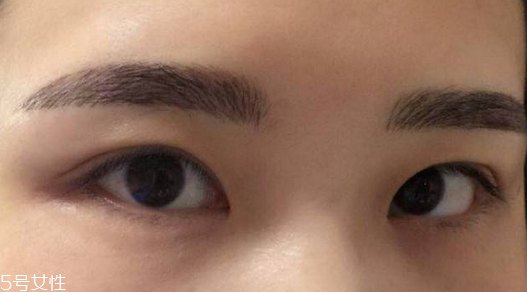 紋眉需要打麻藥嗎 沒這個(gè)必要 紋眉需要打麻藥嗎 沒這個(gè)必要