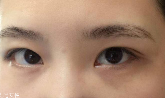 紋眉需要打麻藥嗎 沒這個(gè)必要 紋眉需要打麻藥嗎 沒這個(gè)必要