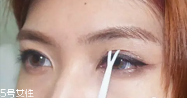 納米無(wú)痕雙眼皮是埋線嗎 納米無(wú)痕雙眼皮介紹 納米無(wú)痕雙眼皮是埋線嗎 納米無(wú)痕雙眼皮介紹
