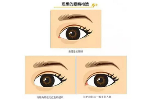 開內(nèi)眼角和外眼角有什么區(qū)別 有不同的美容效果 開內(nèi)眼角和外眼角有什么區(qū)別 有不同的美容效果