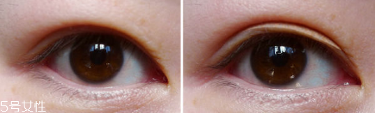 長期用假睫毛雙眼皮貼的危害 適當減少佩戴時間 長期用假睫毛雙眼皮貼的危害 適當減少佩戴時間