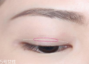 蕾絲雙眼皮貼怎么用 貼法不當(dāng)效果大打折扣 蕾絲雙眼皮貼怎么用 貼法不當(dāng)效果大打折扣