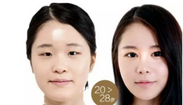 蕾絲雙眼皮貼怎么用 貼法不當(dāng)效果大打折扣 蕾絲雙眼皮貼怎么用 貼法不當(dāng)效果大打折扣