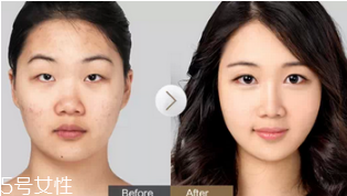 蕾絲雙眼皮貼怎么用 貼法不當(dāng)效果大打折扣 蕾絲雙眼皮貼怎么用 貼法不當(dāng)效果大打折扣