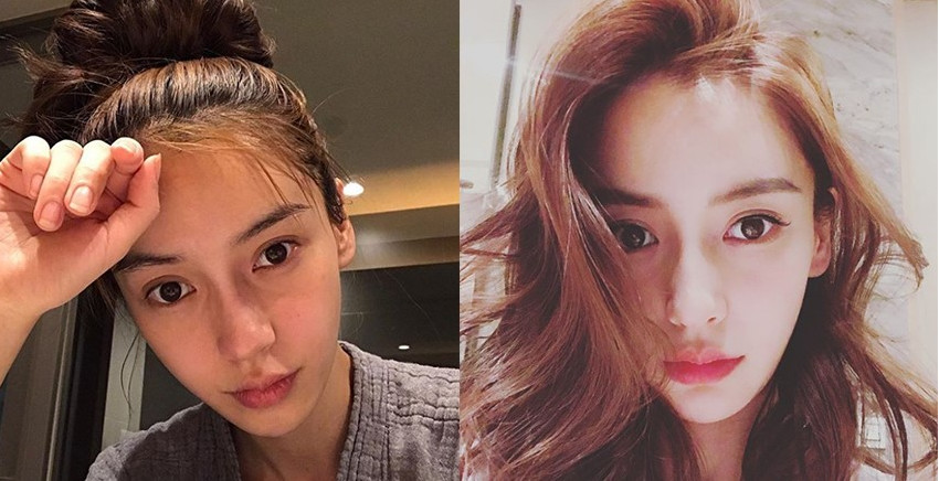 明星怎么祛痘的 當(dāng)紅女星祛痘秘訣 明星怎么祛痘的 當(dāng)紅女星祛痘秘訣