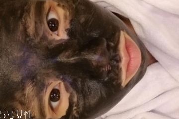 黑臉娃娃傷皮膚嗎 正規(guī)操作不會(huì) 黑臉娃娃傷皮膚嗎 正規(guī)操作不會(huì)