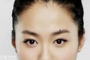 點(diǎn)痣是掛什么科 這個(gè)科室才對