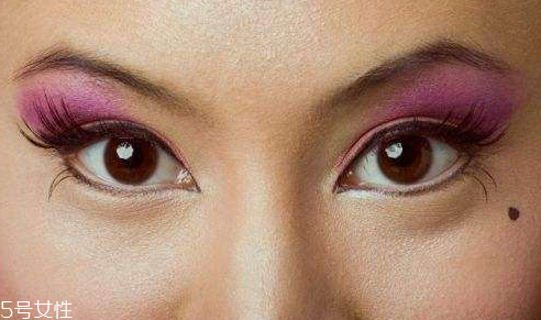 點(diǎn)痣是掛什么科 這個(gè)科室才對