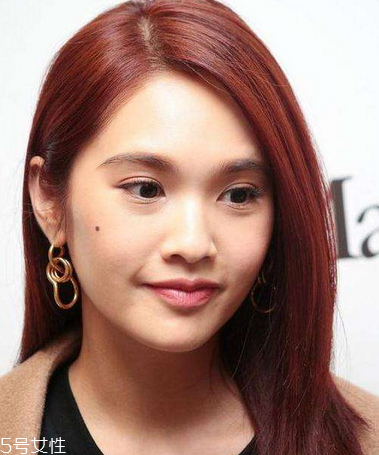 點痣是永久的嗎 點痣后一般不會再長 點痣是永久的嗎 點痣后一般不會再長