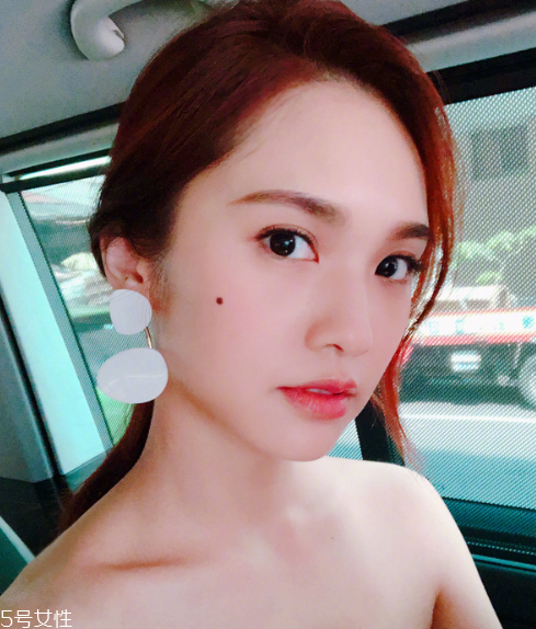 點痣能吃芒果嗎 芒果是發(fā)物不建議吃 點痣能吃芒果嗎 芒果是發(fā)物不建議吃