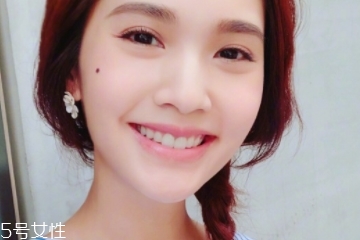 點痣能吃魚嗎 魚屬于發(fā)物 點痣能吃魚嗎 魚屬于發(fā)物