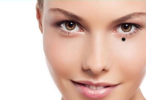 點(diǎn)痣能用洗面奶洗臉嗎 七天后才可以 點(diǎn)痣能用洗面奶洗臉嗎 七天后才可以