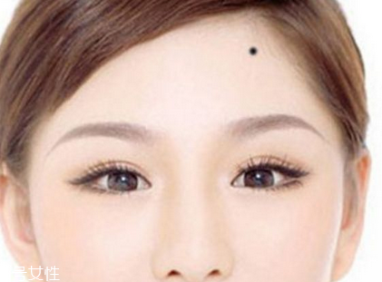 點(diǎn)痣能曬太陽(yáng)嗎 最好是避免 點(diǎn)痣能曬太陽(yáng)嗎 最好是避免