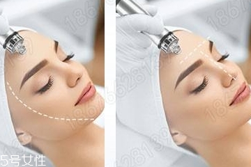 小氣泡溶液使用方法 這樣用就對了 小氣泡溶液使用方法 這樣用就對了