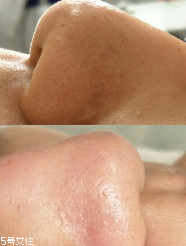 小氣泡溶液使用方法 這樣用就對了 小氣泡溶液使用方法 這樣用就對了