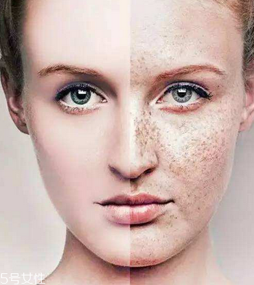 皮秒會反黑嗎 這是正?，F(xiàn)象