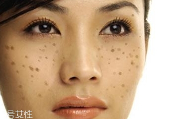 皮秒對(duì)皮膚有傷害嗎 安全不傷皮膚 皮秒對(duì)皮膚有傷害嗎 安全不傷皮膚