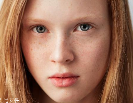 皮秒對(duì)皮膚有傷害嗎 安全不傷皮膚 皮秒對(duì)皮膚有傷害嗎 安全不傷皮膚