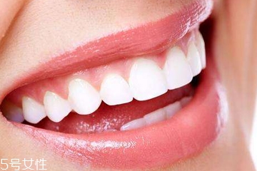 磨砂牙膏有什么好處 清除牙垢好幫手 磨砂牙膏有什么好處 清除牙垢好幫手