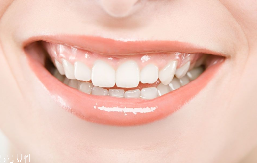 含氟牙膏能預防齲齒嗎 氟化物能對抗齲齒