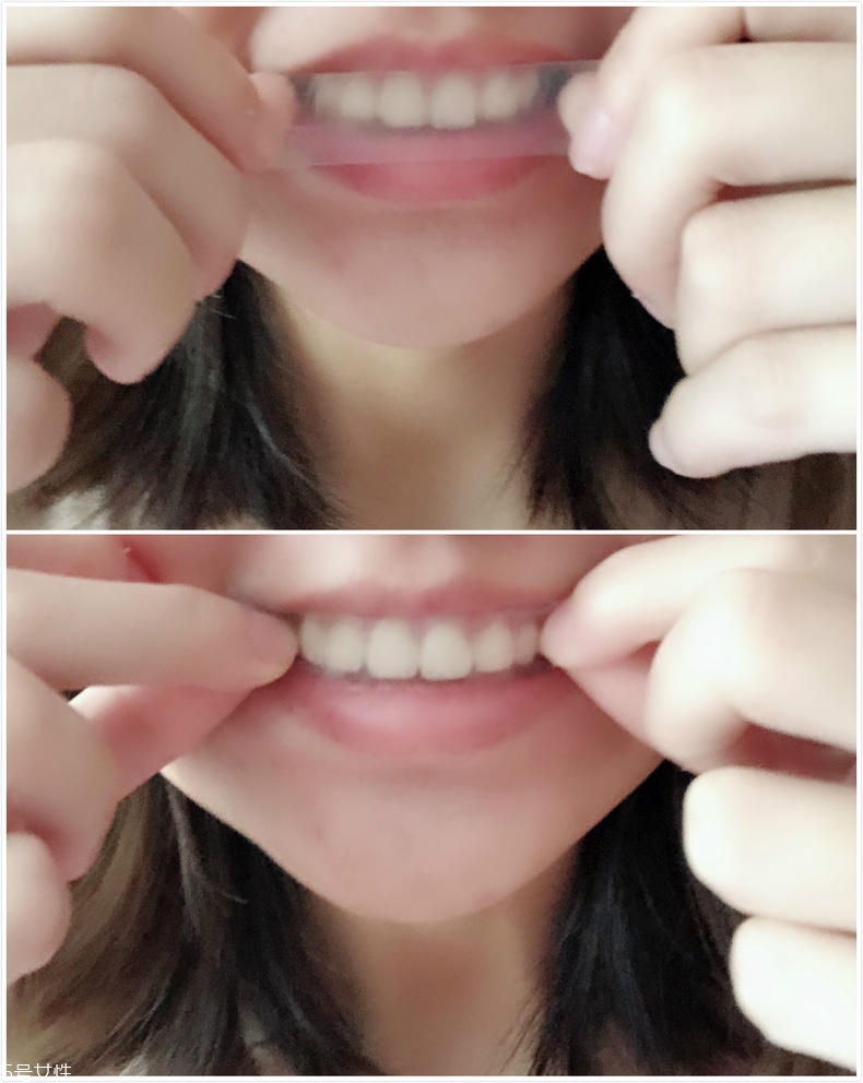 佳潔士美白牙貼有害嗎 不會傷害到牙釉質 佳潔士美白牙貼有害嗎 不會傷害到牙釉質