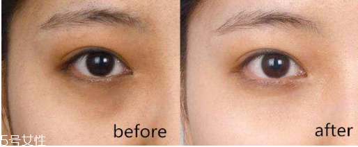 眼霜什么成分能去黑眼圈 2種成分最有效 眼霜什么成分能去黑眼圈 2種成分最有效