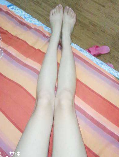 腿毛是遺傳的嗎 有這個(gè)可能 腿毛是遺傳的嗎 有這個(gè)可能