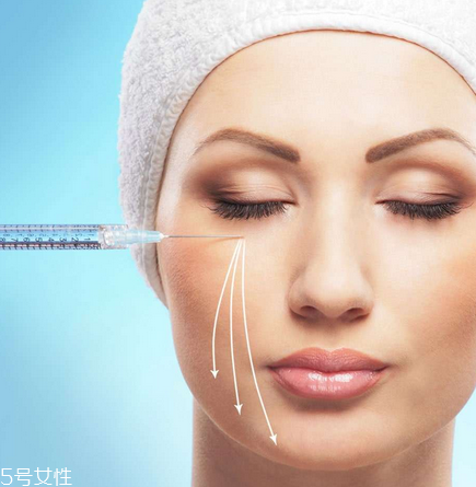 瘦臉針副作用有哪些？