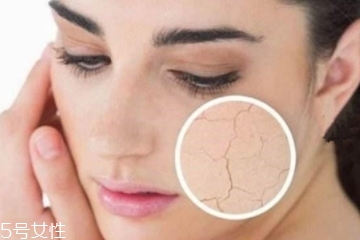 夏天吹空調皮膚會干嗎 做到這幾點就好 夏天吹空調皮膚會干嗎 做到這幾點就好