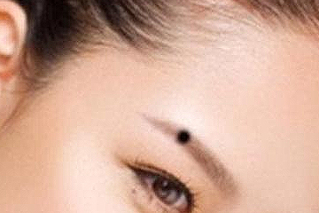 激光去痣后注意事項有哪些 激光去痣后注意事項有哪些