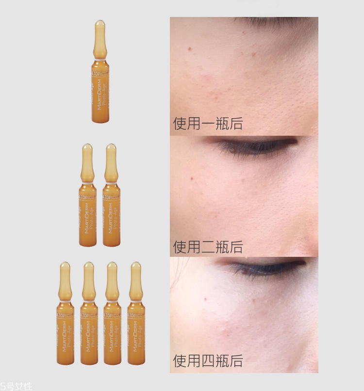 martiderm安瓶敏感肌可以用嗎 痘痘肌和孕婦不適合 martiderm安瓶敏感肌可以用嗎 痘痘肌和孕婦不適合
