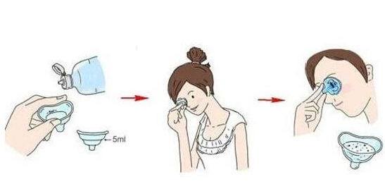 洗眼液可以泡隱形眼鏡嗎 兩者完全不一樣 洗眼液可以泡隱形眼鏡嗎 兩者完全不一樣