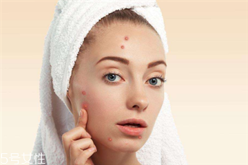 熬夜長(zhǎng)痘痘怎么辦？去除痘痘小竅門(mén)