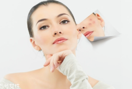 熬夜長(zhǎng)痘痘怎么辦？去除痘痘小竅門(mén)