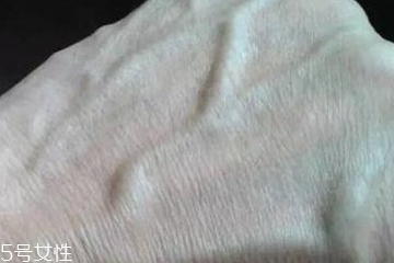 男性青筋凸起要注意 是個(gè)慢性炸彈 男性青筋凸起要注意 是個(gè)慢性炸彈