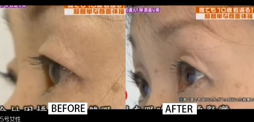 眼尾下垂怎么拯救 2個(gè)方法讓你不再哭喪臉 眼尾下垂怎么拯救 2個(gè)方法讓你不再哭喪臉