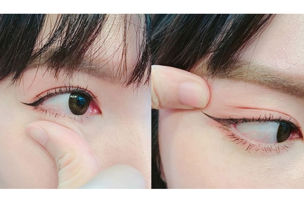 眼尾下垂怎么拯救 2個(gè)方法讓你不再哭喪臉 眼尾下垂怎么拯救 2個(gè)方法讓你不再哭喪臉