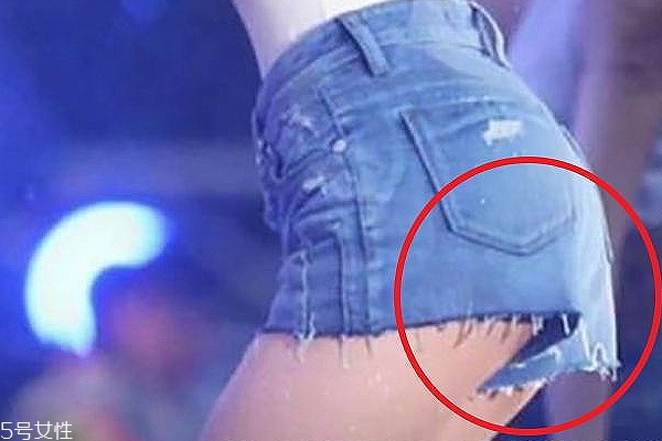 微笑線在哪里 屁股和大腿的分界線 微笑線在哪里 屁股和大腿的分界線