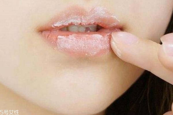 唇部去角質(zhì)的自制方法 這個妙招省錢又有效 唇部去角質(zhì)的自制方法 這個妙招省錢又有效