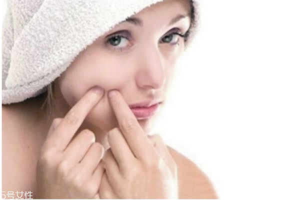 哪種痘痘不可以擠 擠痘痘的正確方法 哪種痘痘不可以擠 擠痘痘的正確方法