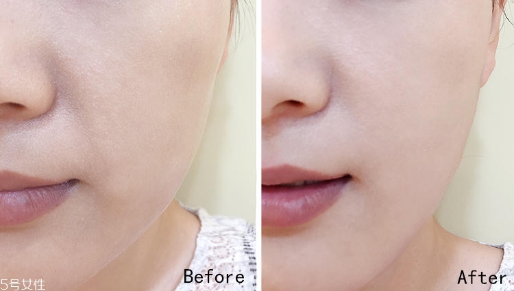 fanbeauty美容儀效果好不好 能到達(dá)真皮層的美膚神器 fanbeauty美容儀效果好不好 能到達(dá)真皮層的美膚神器