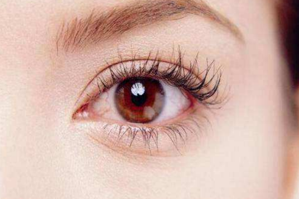 近視眼眼睛植入鏡片安全嗎 近視眼眼睛植入鏡片安全嗎