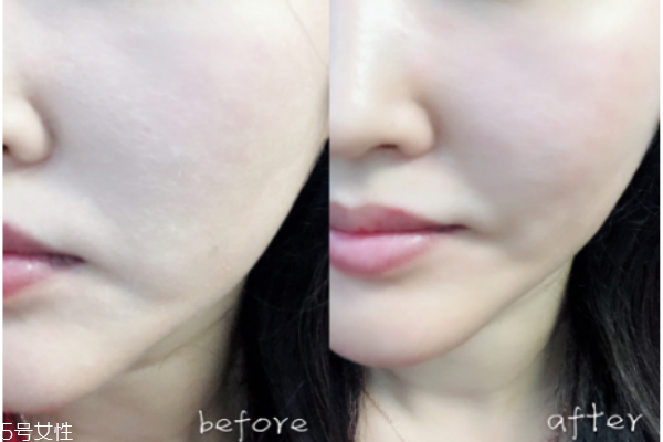 蘭蔻玫瑰花瓣水多少錢 蘭蔻玫瑰花瓣水價格 蘭蔻玫瑰花瓣水多少錢 蘭蔻玫瑰花瓣水價格