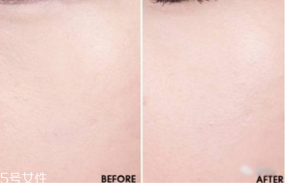 蘭蔻玫瑰花高光蜜粉好用嗎 蘭蔻玫瑰花高光專柜價 蘭蔻玫瑰花高光蜜粉好用嗎 蘭蔻玫瑰花高光專柜價