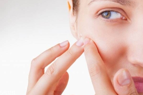 痘痘貼什么時候貼 剛擠完有傷口的時候 痘痘貼什么時候貼 剛擠完有傷口的時候