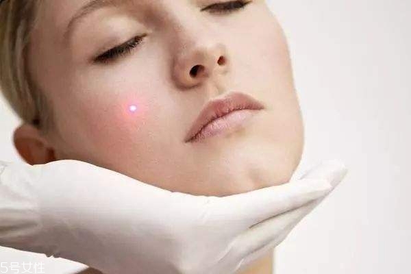 什么痘痘不能擠 這種痘擠破一定會(huì)留疤 什么痘痘不能擠 這種痘擠破一定會(huì)留疤