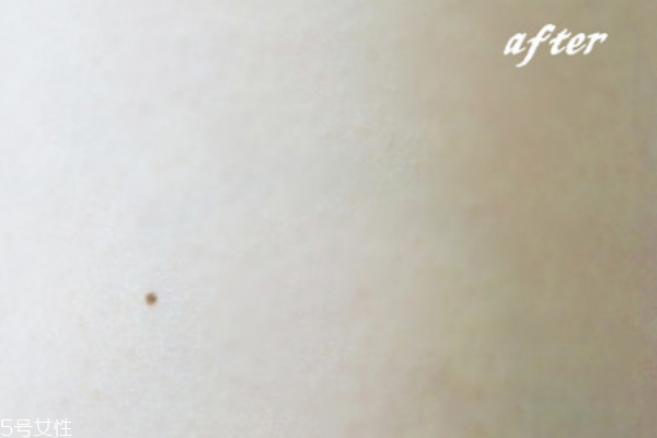 beely身體乳怎么樣 雞皮的好選擇 beely身體乳怎么樣 雞皮的好選擇