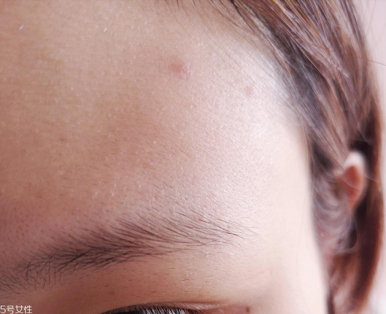 悅詩風吟小白管好用嗎 去痘印能力驚人