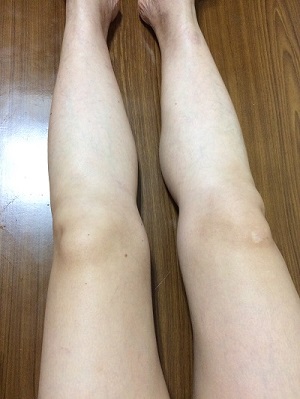 體膜怎么用 體膜什么時(shí)候用 體膜怎么用 體膜什么時(shí)候用